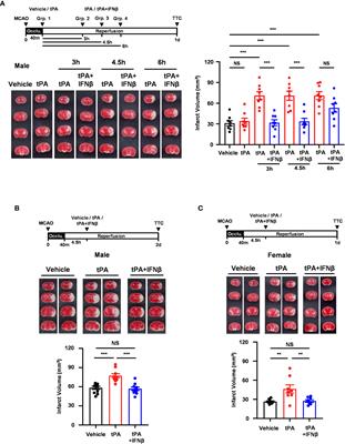 Interferon-β modulates microglial polarization to ameliorate delayed tPA-exacerbated brain injury in ischemic stroke